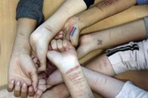 خودزنی دختران در مدارس ایران را ببینید! + عکس خودزنی دختران در مدارس ایران را ببینید! + عکس