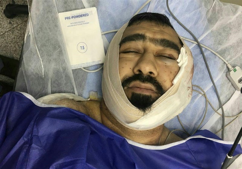 حمله خونین یکی از اوباش منطقه شرق تهران به یک طلبه +عکس حمله خونین یکی از اوباش منطقه شرق تهران به یک طلبه +عکس