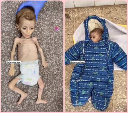 لباس های کودکان غزه به جای کوچک شدن برایشان بزرگتر شد / عکس