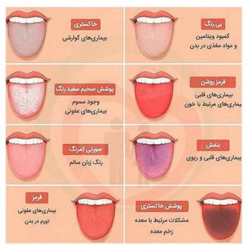 رنگ زبانتان چه پیامی دارد؟