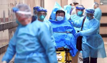 ژاپنی ها با روش جدید و ساده مبتلایان به کرونا را درمان کردند  ژاپنی ها با روش جدید و ساده مبتلایان به کرونا را درمان کردند