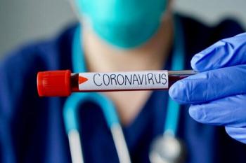 شناسایی 1234 مبتلای جدید به ویروس کرونا/913 نفر بهبود یافتند