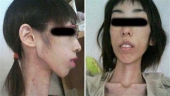 افشای راز شکنجه وحشتناک دختر ژاپنی به دست پدربزرگ و مادربزرگش