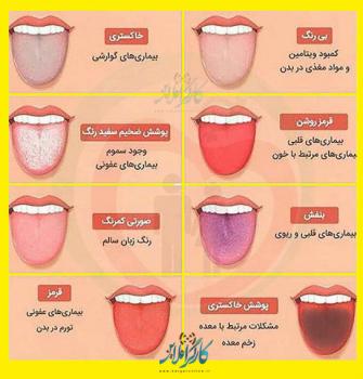 هشت بیماری خطرناکی که رنگ زبان شما به آسانی نشان می دهد